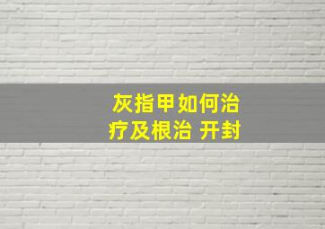 灰指甲如何治疗及根治 开封